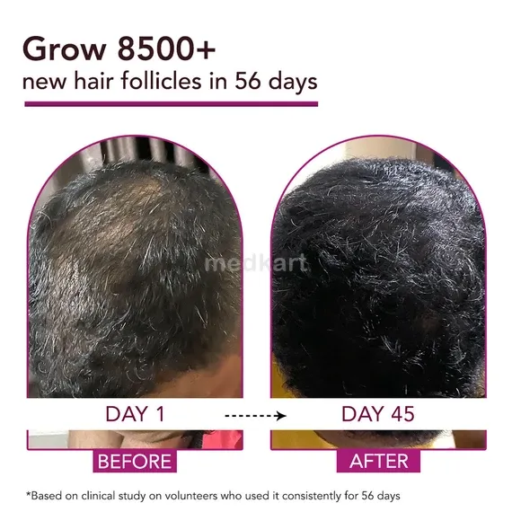 bontress pro plus scalp serum 60 ml